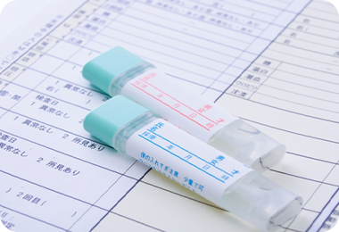 便潜血検査が陽性の場合、大腸内視鏡検査受けた方が良い？